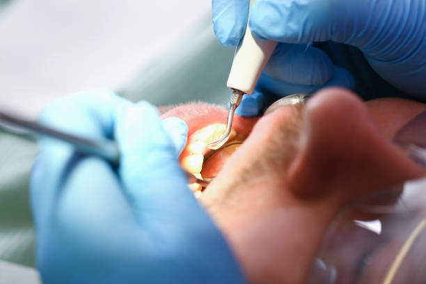 Best Emergency Root Canal Treatment in Fifth Ward, LA